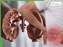 Signs You May Have Kidney Disease